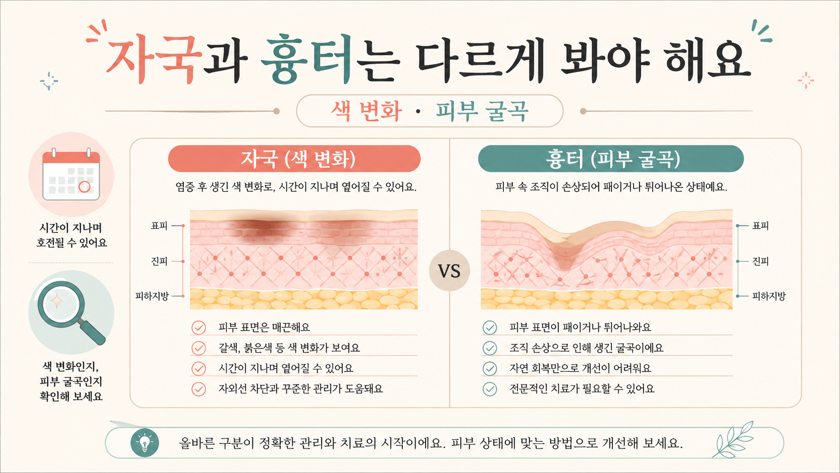 여드름 자국과 흉터를 색 변화와 피부 굴곡으로 비교하는 정보카드