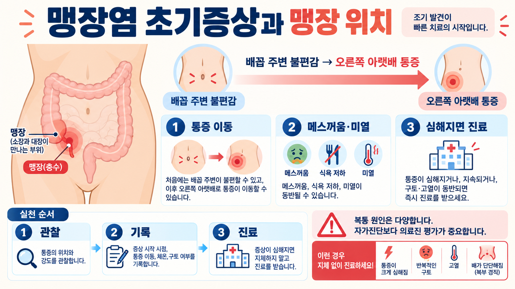 맹장염 초기증상과 맹장 위치: 급성충수염 의심 시 확인할 신호 정보 카드