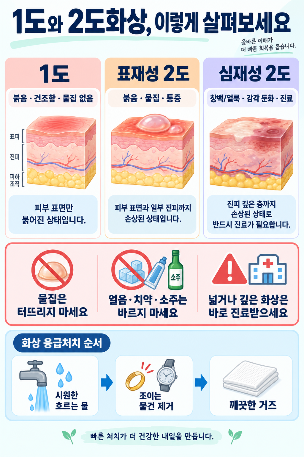 화상 단계별 특징과 응급처치: 1도·2도·3도 구분법 관련 정보 카드