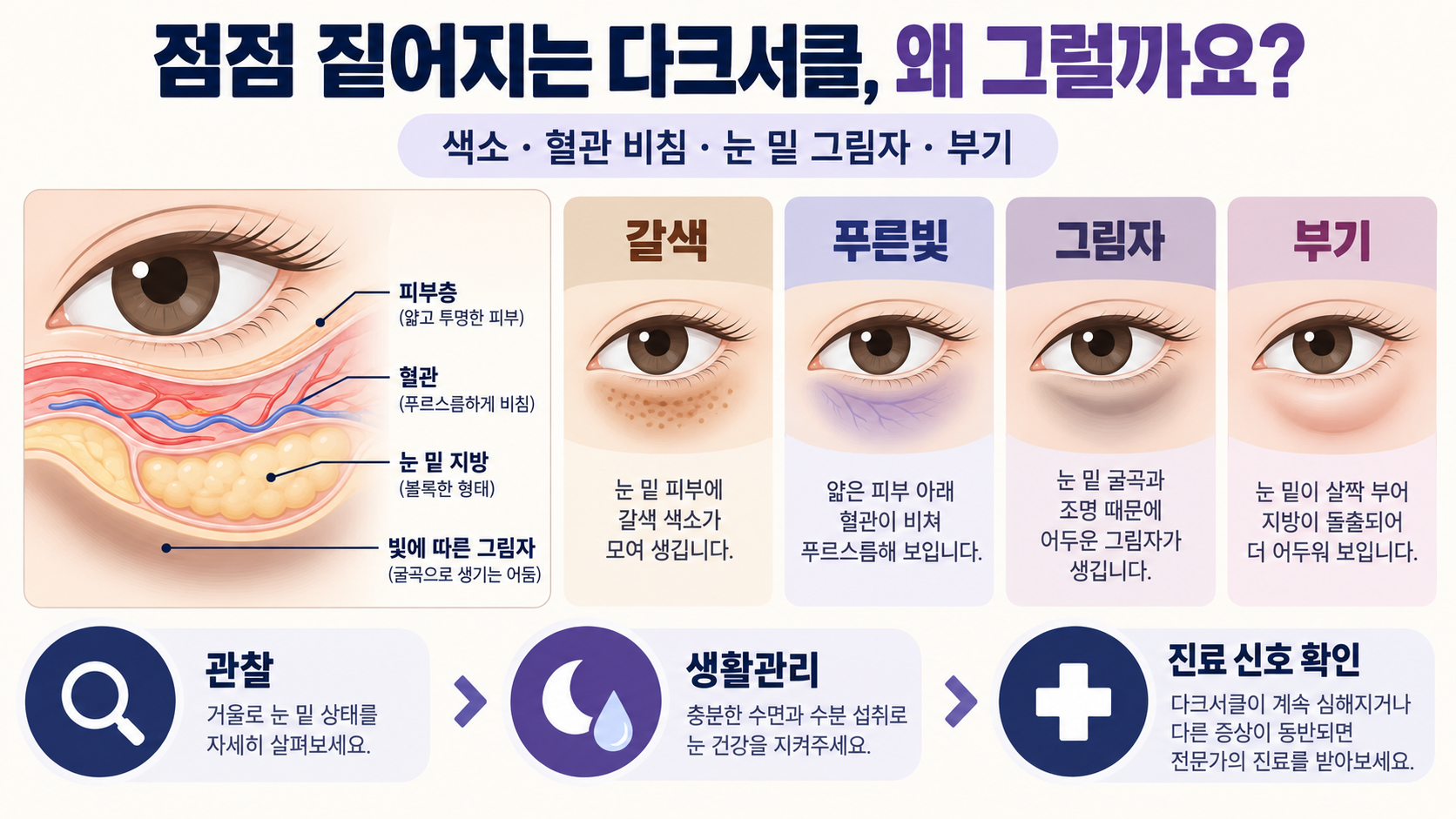 점점 짙어지는 다크서클, 왜 그런 걸까요? 정보 카드