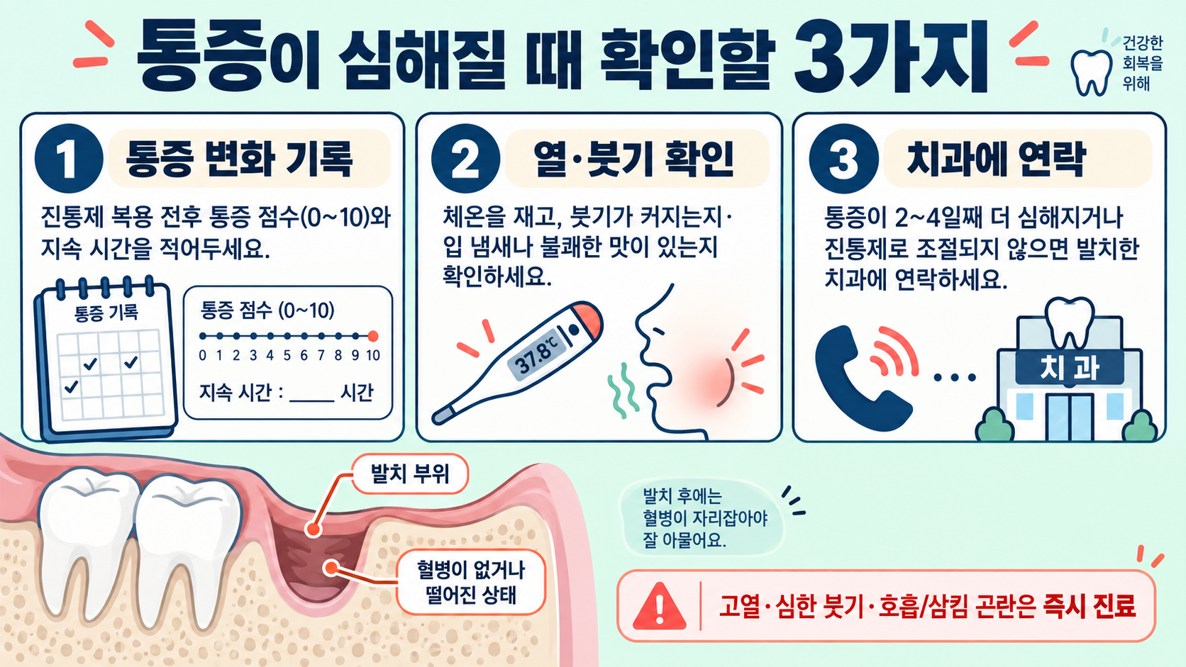 매복사랑니 발치 후 드라이소켓: 증상·대처·진료 신호 관련 정보 카드