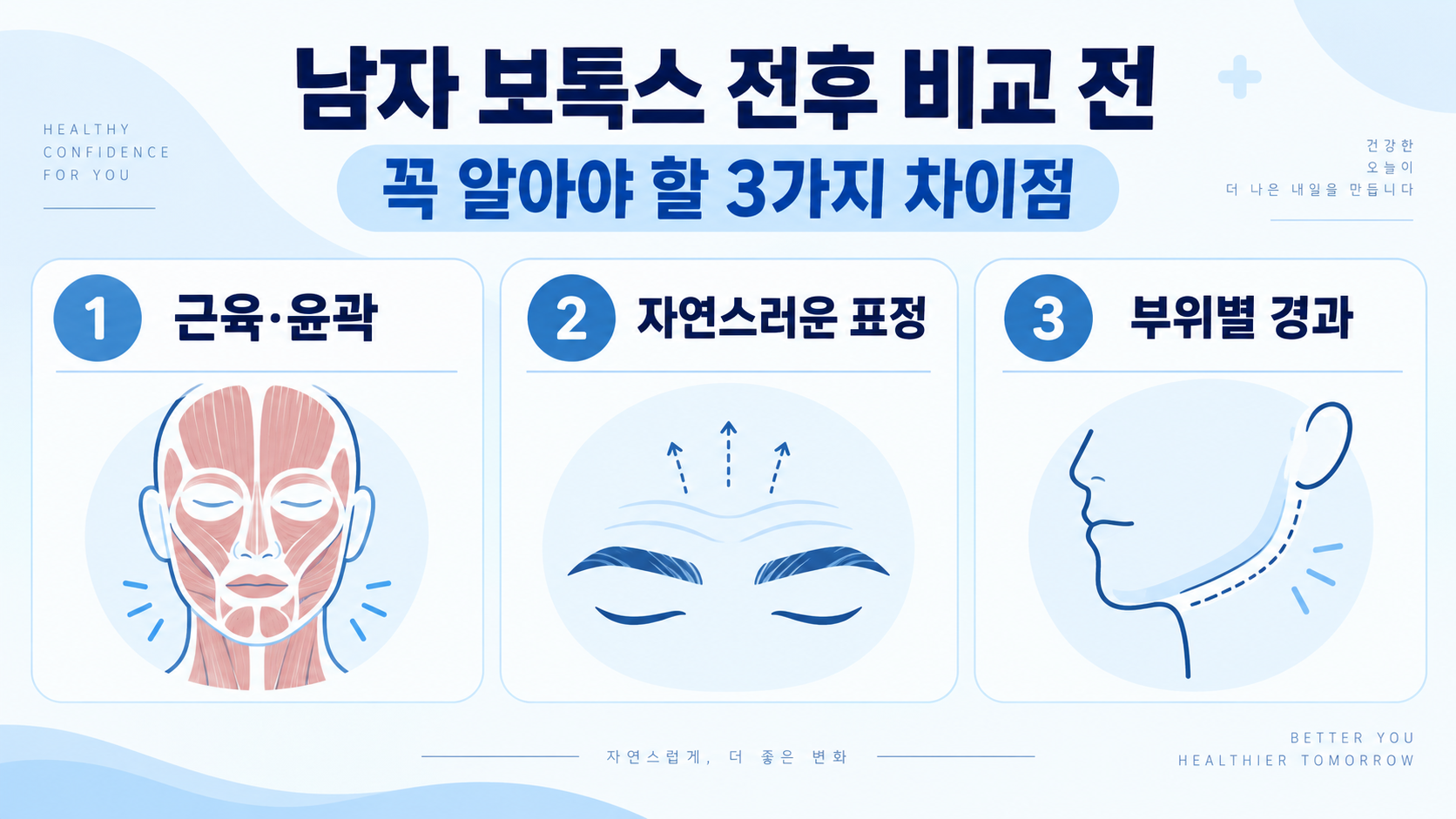 남자 보톡스 전후 비교 전, 꼭 알아야 할 3가지 차이점 정보 카드