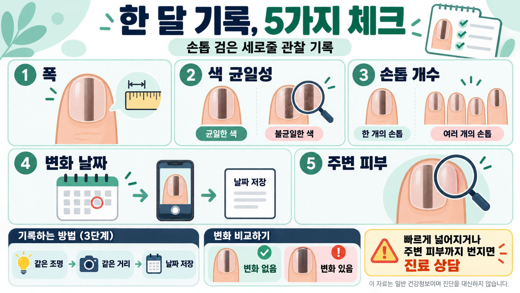 손톱 검은 세로줄: 흑색종을 걱정할 때 확인할 신호와 진료 기준 관련 정보 카드