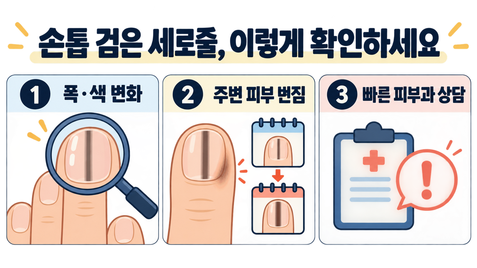 손톱 검은 세로줄: 흑색종을 걱정할 때 확인할 신호와 진료 기준 대표 이미지