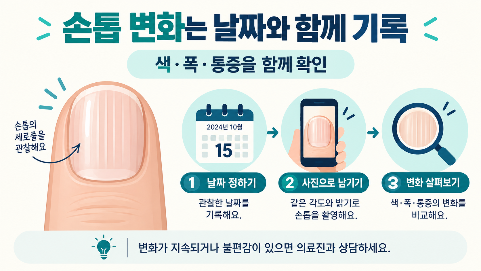 손톱 세로줄, 건강 신호로 보는 법과 진료가 필요한 변화 관련 정보 카드