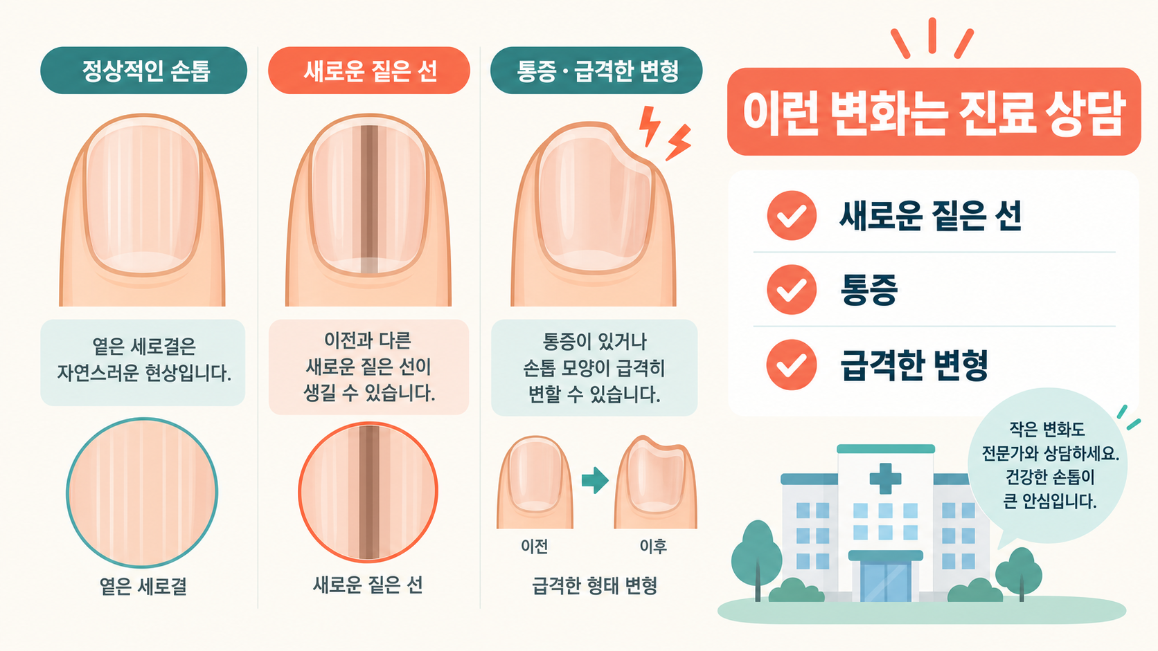 손톱 세로줄, 건강 신호로 보는 법과 진료가 필요한 변화 확인 정보 카드