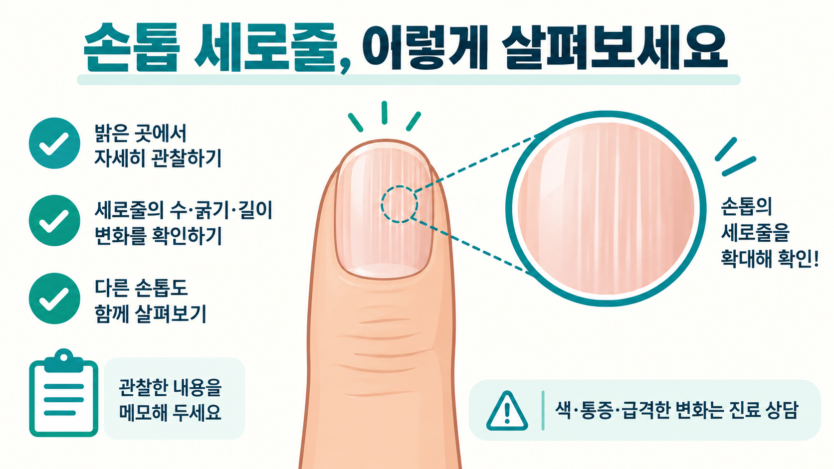 손톱 세로줄, 건강 신호로 보는 법과 진료가 필요한 변화 정보 카드