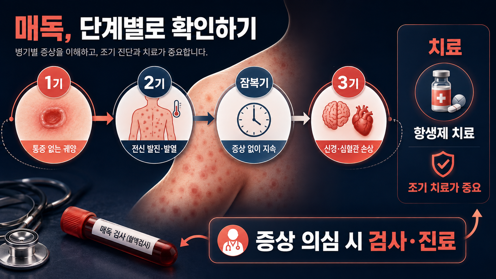 매독의 병기와 검사·진료 흐름을 보여 주는 정보 카드